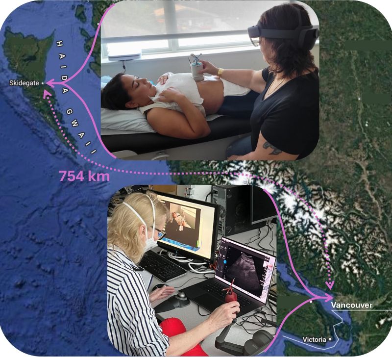 750 km tele-ultrasound clinical study